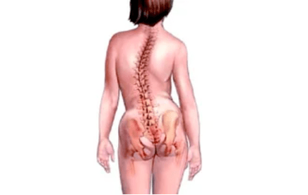 Las razones para el desarrollo de la osteocondrosis cervical