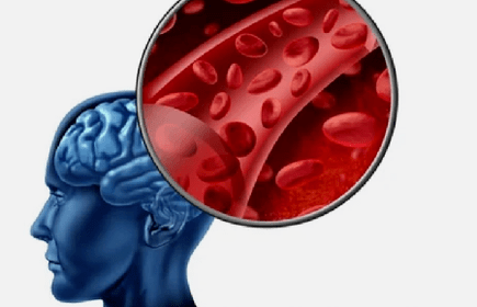 Síntomas de la osteocondrosis de la columna cervical