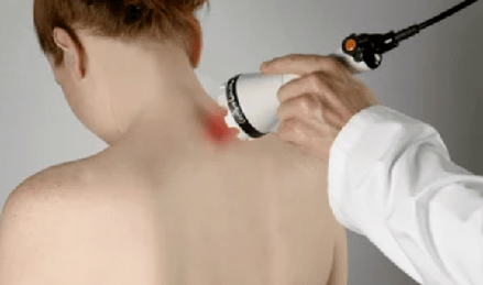 Tratamiento de la osteocondrosis cervical por fisioterapia